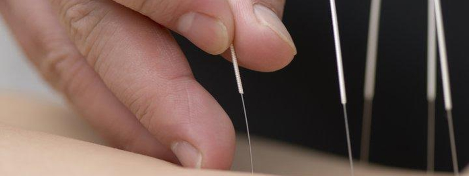 Quali sono le principali indicazioni dell’agopuntura?